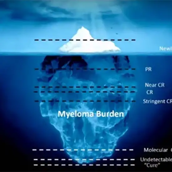 multiple myeloma screening